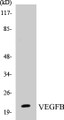 Western blot analysis of extracts from Jurkat cells, using VEGFB Antibody. 