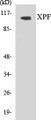 Western blot analysis of extracts from 293 cells, using XPF Antibody. 