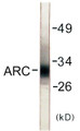 Western blot analysis of extracts from HeLa cells, using ARC Antibody. The lane on the right is treated with the synthesized peptide.