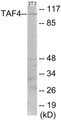Western blot analysis of extracts from NIH-3T3 cells, using TAF4 Antibody. The lane on the right is treated with the synthesized peptide.