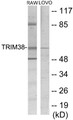 Western blot analysis of extracts from LOVO/RAW264.7 cells, using TRIM38 Antibody. The lane on the right is treated with the synthesized peptide.