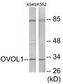 Western blot analysis of extracts from K562/A549 cells, using OVOL1 Antibody. The lane on the right is treated with the synthesized peptide.