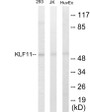Western blot analysis of extracts from 293/Jurkat/HuvEc cells, using KLF11 Antibody. The lane on the right is treated with the synthesized peptide.