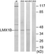 Western blot analysis of extracts from Jurkat/293/HuvEc cells, using LMX1B Antibody. The lane on the right is treated with the synthesized peptide.