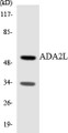 Western blot analysis of extracts from COS7/COLO205 cells, using ADA2L Antibody. The lane on the right is treated with the synthesized peptide.