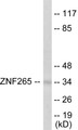 Western blot analysis of extracts from HeLa cells, using ZNF265 Antibody.