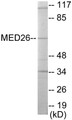 Western blot analysis of extracts from LOVO cells, using MED26 Antibody. The lane on the right is treated with the synthesized peptide.