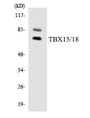 Western blot analysis of extracts from HuvEc/HeLa/Jurkat cells, using TBX15/18 Antibody.