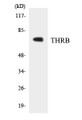 Western blot analysis of extracts from NIH-3T3 cells, using THRB Antibody.