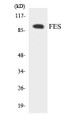 Western blot analysis of extracts from HuvEc cells, treated with serum 20% 30', using FES Antibody. The lane on the right is treated with the synthesized peptide.