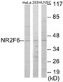 Western blot analysis of extracts from HeLa/HuvEc/293 cells, using NR2F6 Antibody.