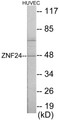 Western blot analysis of extracts from HuvEc cells, using ZNF24 Antibody. The lane on the right is treated with the synthesized peptide.