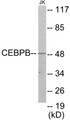 Western blot analysis of extracts from Jurkat cells, using CEBPB Antibody. The lane on the right is treated with the synthesized peptide.