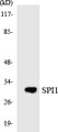 Western blot analysis of extracts from COS7 cells, using SPI1 Antibody. The lane on the right is treated with the synthesized peptide.