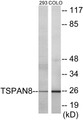 Western blot analysis of extracts from 293/COLO cells, using TSPAN8 Antibody.
