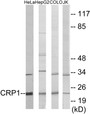 Western blot analysis of extracts from HeLa/HepG2/COLO/Jurkat cells, using CRP1 Antibody.