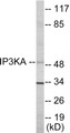 Western blot analysis of extracts from HuvEc cells, using IP3KA Antibody. The lane on the right is treated with the synthesized peptide.