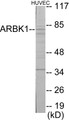 Western blot analysis of extracts from HuvEc cells, using ARBK1 Antibody. The lane on the right is treated with the synthesized peptide.