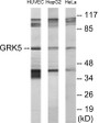 Western blot analysis of extracts from HeLa/HepG2/HuvEc cells, using GRK5 Antibody. The lane on the right is treated with the synthesized peptide.
