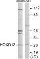 Western blot analysis of extracts from COLO205/HucEc cells, treated with serum 20% 15', using HOXD12 Antibody. The lane on the right is treated with the synthesized peptide.