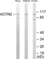 Western blot analysis of extracts from HepG2/HeLa/HuvEc cells, using Actinin alpha-2/3 Antibody.