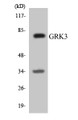 Western blot analysis of extracts from HepG2/HeLa cells, using GRK3 Antibody. The lane on the right is treated with the synthesized peptide.