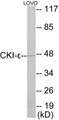 Western blot analysis of extracts from LOVO cells, using CKI-epsilon Antibody.