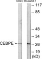 Western blot analysis of extracts from LOVO/RAW264.7 cells, using CEBPD/E Antibody. The lane on the right is treated with the synthesized peptide.