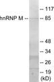 Western blot analysis of extracts from HT-29 cells, using hnRNP M Antibody.