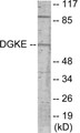 Western blot analysis of extracts from K562 cells, using DGKE Antibody. The lane on the right is treated with the synthesized peptide.