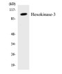 Western blot analysis of extracts from Jurkat cells, treated with insulin 0.01U/ml 15', using Hexokinase-3 Antibody. The lane on the right is treated with the synthesized peptide.