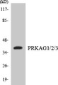 Western blot analysis of extracts from 293/Jurkat cells, using PRKAG1/2/3 Antibody. The lane on the right is treated with the synthesized peptide.