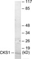 Western blot analysis of extracts from Jurkat cells, treated with serum 20% 15’, using CKS1 Antibody.
