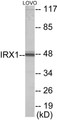Western blot analysis of extracts from LOVO cells, using IRX1 Antibody. The lane on the right is treated with the synthesized peptide.