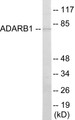 Western blot analysis of extracts from HepG2 cells, using ADARB1 Antibody. The lane on the right is treated with the synthesized peptide.