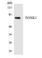 Western blot analysis of extracts from Jurkat cells, using FOXK1 Antibody. The lane on the right is treated with the synthesized peptide.