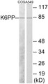 Western blot analysis of extracts from A549/COS7 cells, using K6PP Antibody. The lane on the right is treated with the synthesized peptide.