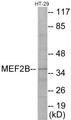 Western blot analysis of extracts from HT-29 cells, using MEF2B Antibody. The lane on the right is treated with the synthesized peptide.