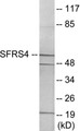 Western blot analysis of extracts from LOVO cells, using SFRS4 Antibody. The lane on the right is treated with the synthesized peptide.