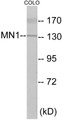 Western blot analysis of extracts from COLO cells, using MN1 Antibody. The lane on the right is treated with the synthesized peptide.