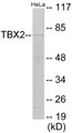 Western blot analysis of extracts from HeLa cells, using TBX2 Antibody. The lane on the right is treated with the synthesized peptide.