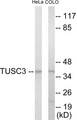 Western blot analysis of extracts from COLO205/HeLa cells, using TUSC3 Antibody.