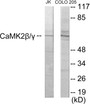 Western blot analysis of extracts from COLO205/Jurkat cells, using CaMK2 beta/gamma Antibody. The lane on the right is treated with the synthesized peptide.