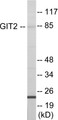 Western blot analysis of extracts from HepG2 cells, using GIT2 Antibody. The lane on the right is treated with the synthesized peptide.