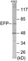Western blot analysis of extracts from K562 cells, using ZNF147 Antibody. The lane on the right is treated with the synthesized peptide.