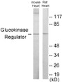 Western blot analysis of extracts from mouse heart/rat heart cells, using Glucokinase Regulator Antibody. The lane on the right is treated with the synthesized peptide.