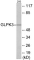 Western blot analysis of extracts from 293 cells, using GK3 Antibody. The lane on the right is treated with the synthesized peptide.