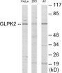 Western blot analysis of extracts from HeLa/293/Jurkat cells, using GK2 Antibody. The lane on the right is treated with the synthesized peptide.