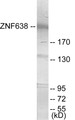 Western blot analysis of extracts from HepG2 cells, treated with serum 20% 15’, using ZNF638 Antibody.