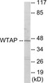 Western blot analysis of extracts from HuvEc cells, using WTAP Antibody. The lane on the right is treated with the synthesized peptide.